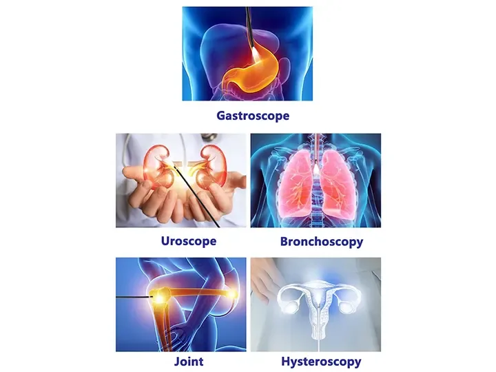 Medical ENT endoscope equipment4
