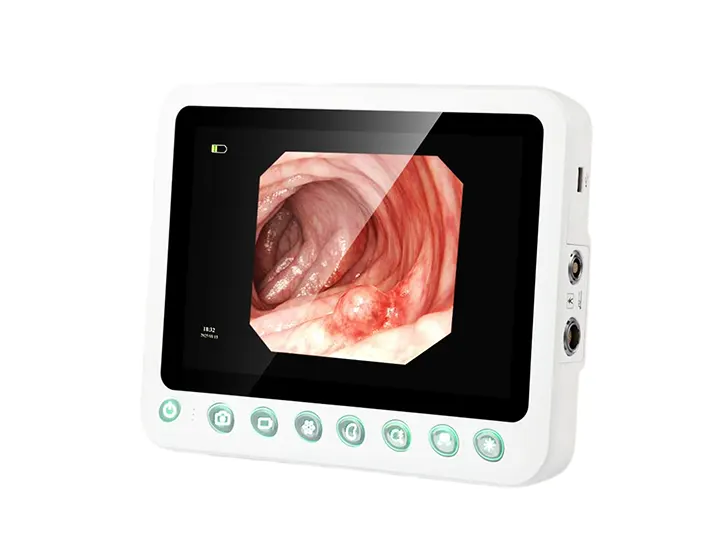 Medical ENT endoscope equipment2