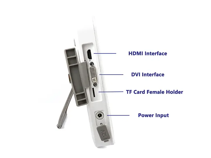 XBX Portable medical endoscope host