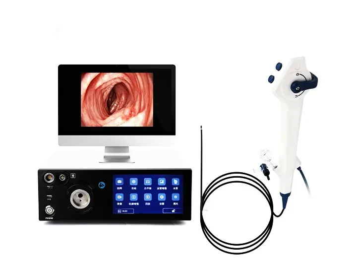 Customized solutions for medical endoscopes: achieving excellent diagnosis and treatment with precise adaptation