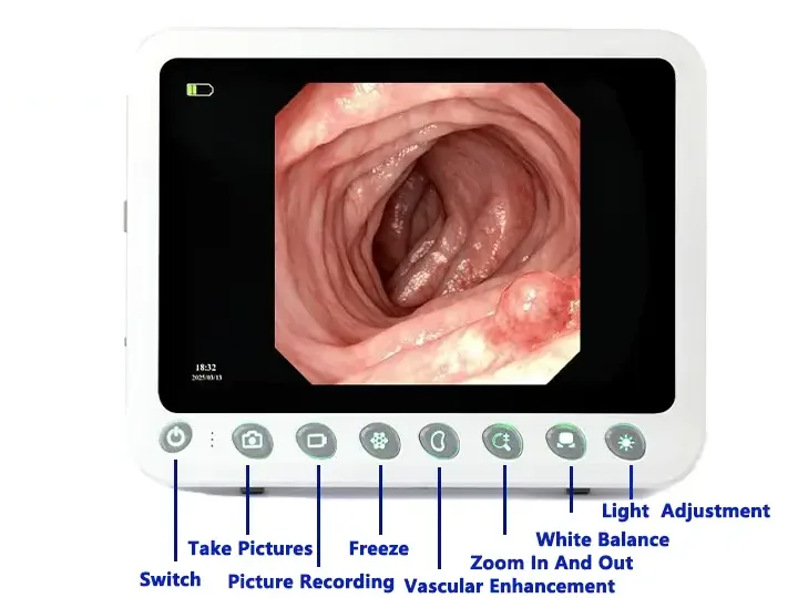 Endoscope Image Processor Portable Host