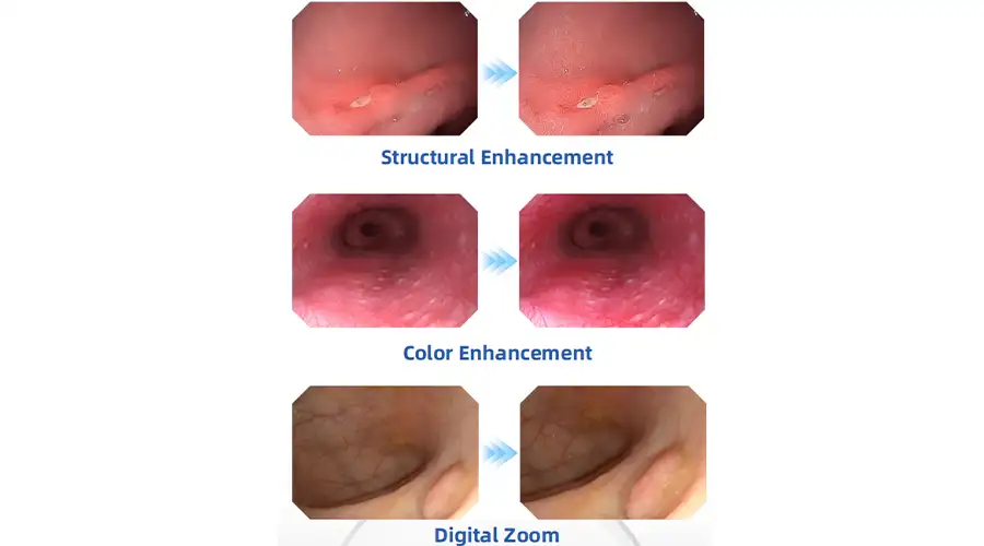 Vision Clarity For Confident Diagnosis