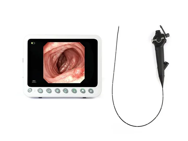 Medical ENT endoscope equipment