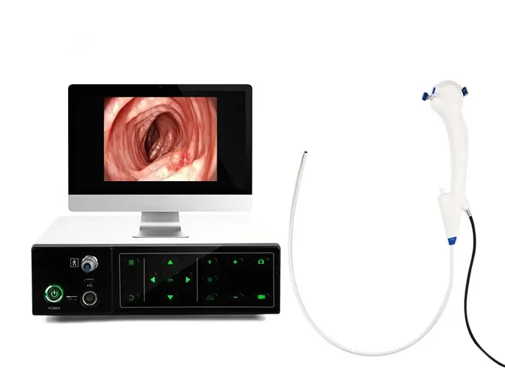 Bronchoscopy