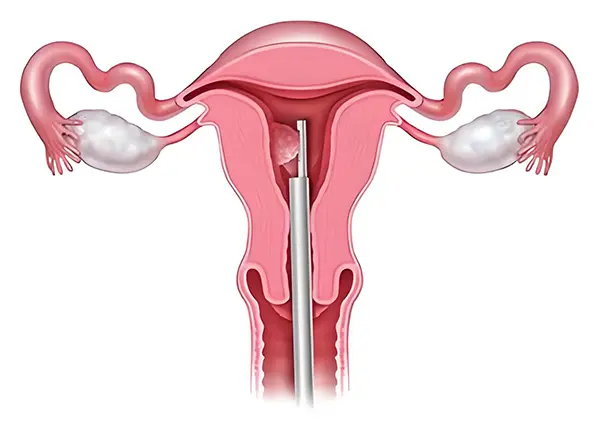 Diagnostic hysteroscopes