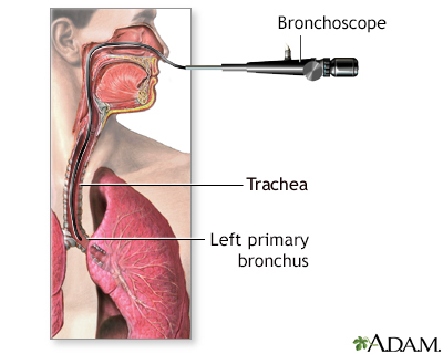 bronchoscope