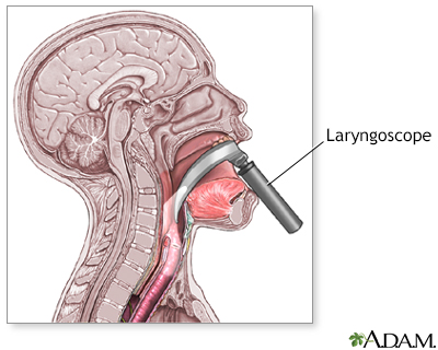 bronchoscope