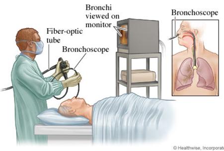 bronchoscope