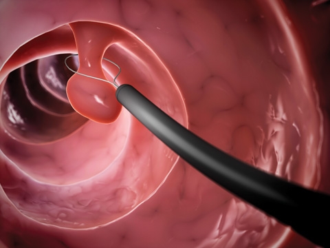 Colonoscope