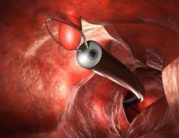 Colonoscope