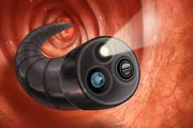 Colonoscope