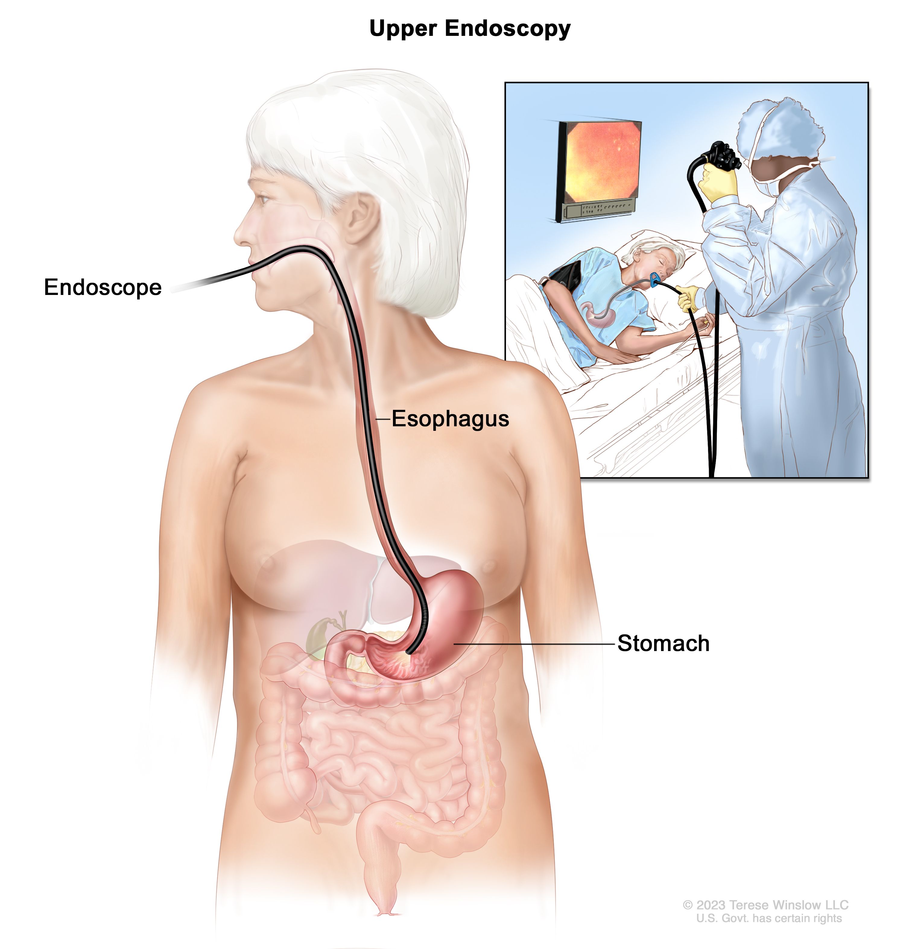 endoscope