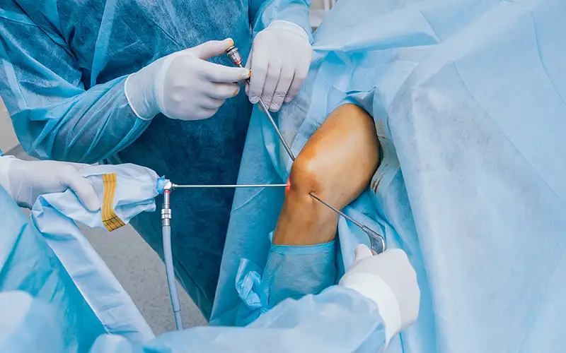 knee-arthroscopy-changing-practice
