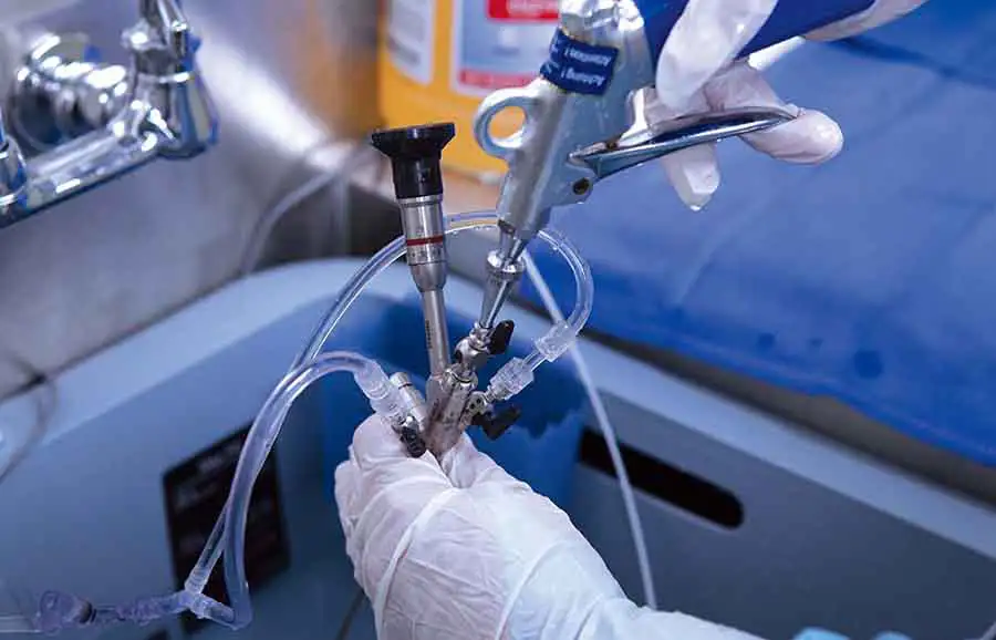 Why Customized ODM Endoscope Devices Improve Patient Care